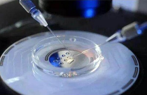 赴泰生子过程注意事项有哪些？需要提前做好哪些准备？