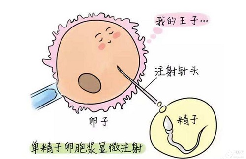 防止不孕不育的措施